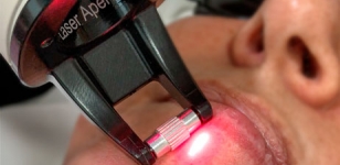 ​RESURFACING CON FRAX PRO 1550
