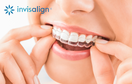  CONEIXES INVISALIGN?